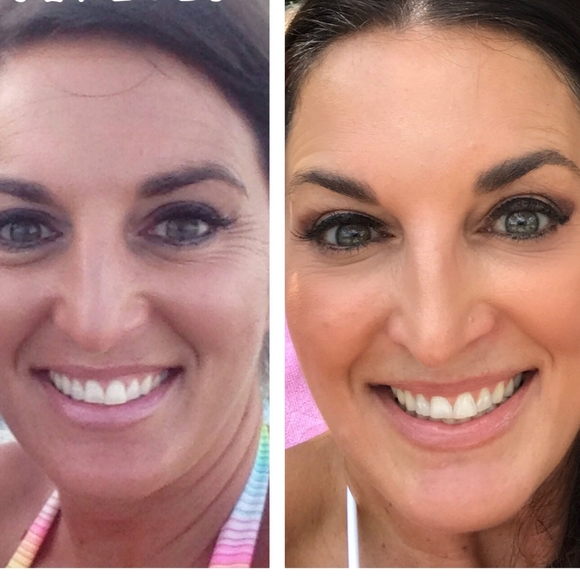 PREORDER ONLY Anti-Wrinkle/Crow's Feet/Sagging Skin - Picture 2 of 4